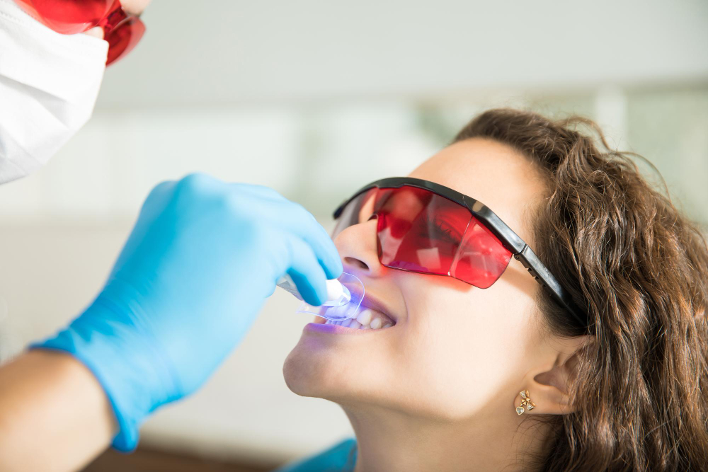 blanqueamiento dental madrid